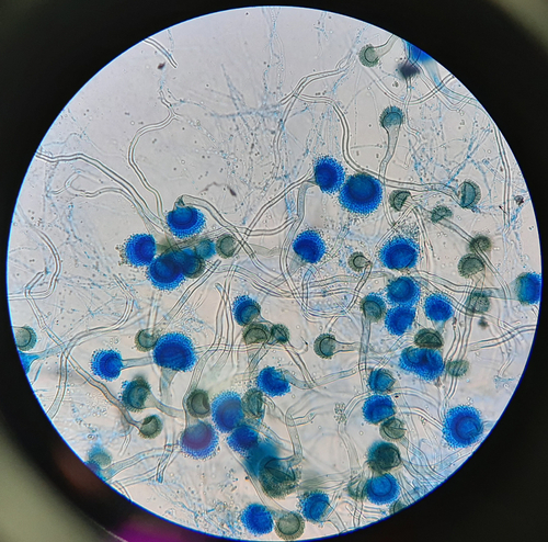 Aspergillus fumigatus