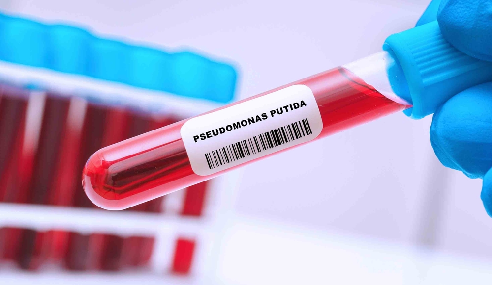 Pseudomonas, batterio "mangiaplastica"