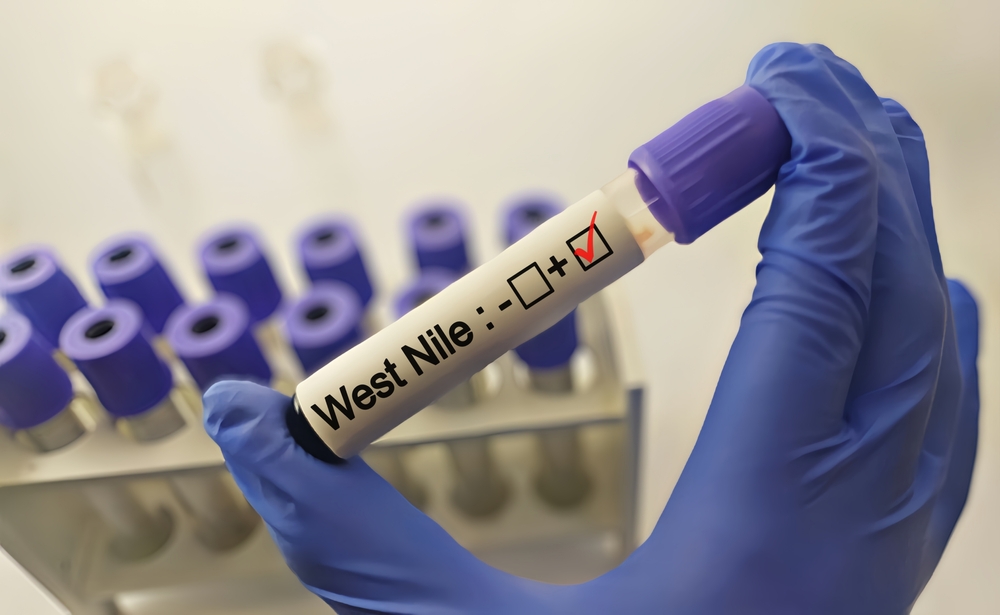 West Nile sintomi