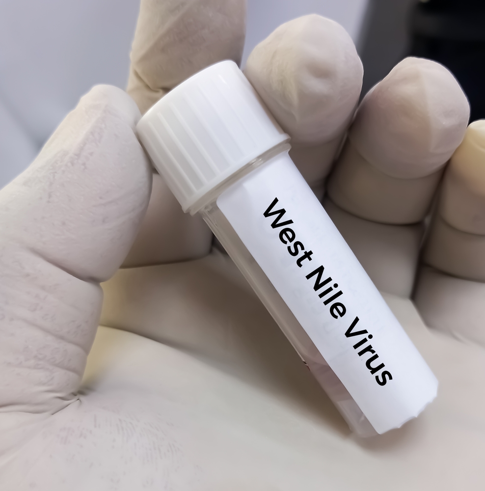 West Nile Fiaso ospedali