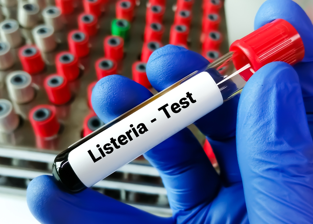 Allarme Listeria