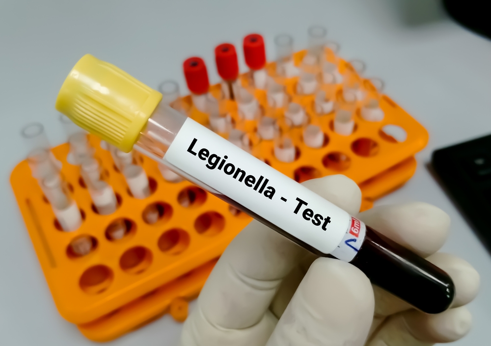 Legionella Milano ambiente